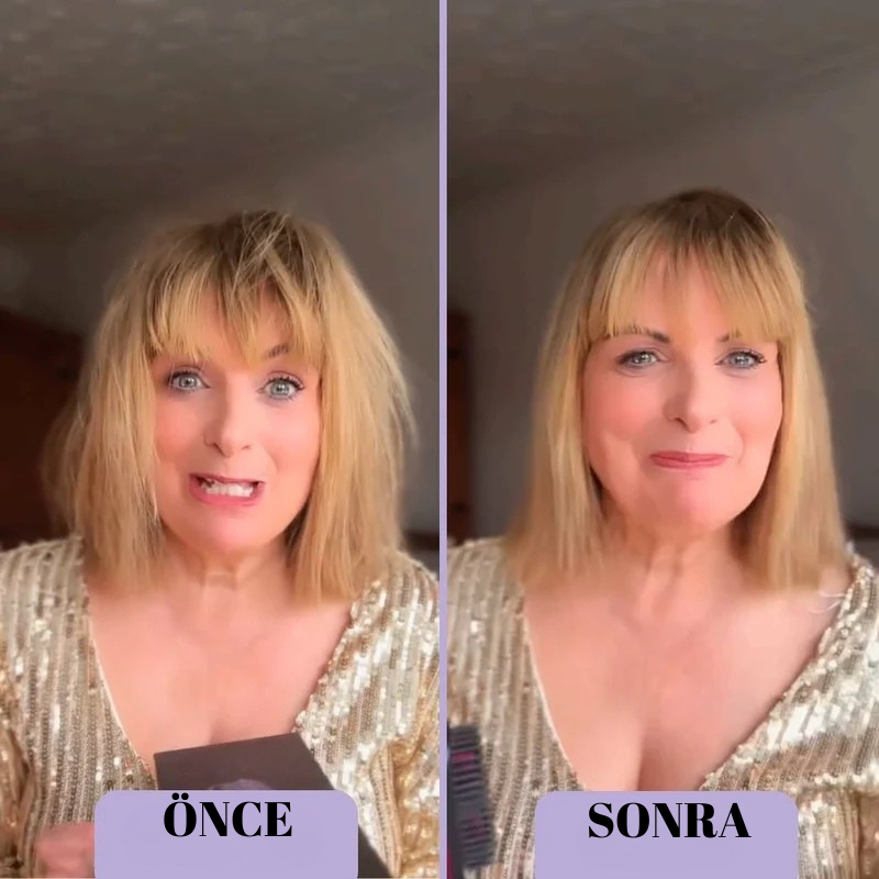 Önce Sonra.png__PID:71fbb164-1278-41f5-9d13-0c22f55ff97e